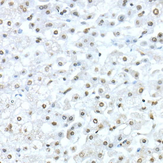 Immunohistochemistry: TEAD1 Antibody - Azide and BSA Free [TEAD1] - Immunohistochemistry analysis of paraffin-embedded Human liver using TEAD1 Rabbit pAb  at dilution of 1:50 (40x lens). High pressure antigen retrieval performed with 0.01M Citrate Bufferr (pH 6.0) prior to IHC staining.