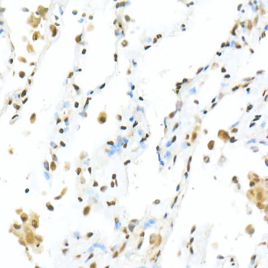 Immunohistochemistry: TEAD1 Antibody - Azide and BSA Free [TEAD1] - Immunohistochemistry analysis of paraffin-embedded Human lung using TEAD1 Rabbit pAb  at dilution of 1:50 (40x lens). High pressure antigen retrieval performed with 0.01M Citrate Bufferr (pH 6.0) prior to IHC staining.