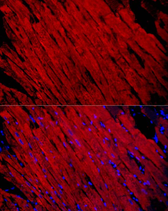 Immunocytochemistry/ Immunofluorescence: Myosin Heavy Chain 1 Antibody - Azide and BSA Free [Myosin Heavy Chain 1] - Immunofluorescence analysis of paraffin-embedded rat heart using Myosin Heavy Chain 1 Rabbit pAb  at dilution of 1:100 (40x lens). Secondary antibody: Cy3-conjugated Goat anti-Rabbit IgG (H+L)  at 1:500 dilution. Blue: DAPI for nuclear staining.