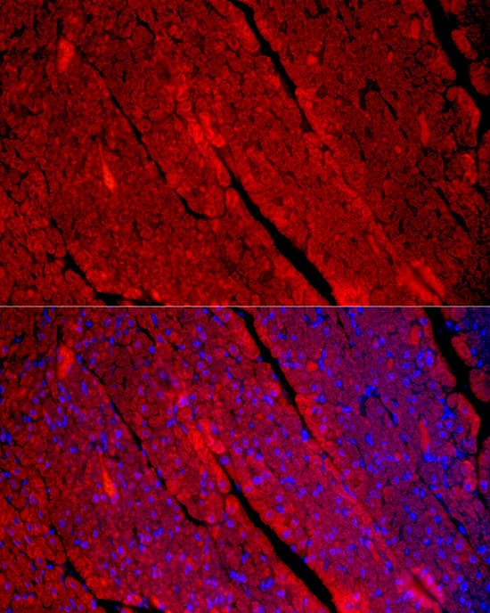 Immunocytochemistry/ Immunofluorescence: Myosin Heavy Chain 1 Antibody - Azide and BSA Free [Myosin Heavy Chain 1] - Immunofluorescence analysis of paraffin-embedded Human heart using Myosin Heavy Chain 1 Rabbit pAb  at dilution of 1:100 (40x lens). Secondary antibody: Cy3-conjugated Goat anti-Rabbit IgG (H+L)  at 1:500 dilution. Blue: DAPI for nuclear staining.