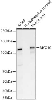 Western Blot: Myosin 1C Antibody - BSA Free [Myosin 1C] - Western blot analysis of various lysates, using Myosin 1C Rabbit pAb  at 1:1500 dilution.Secondary antibody: HRP Goat Anti-Rabbit IgG (H+L)  at 1:10000 dilution.Lysates/proteins: 25ug per lane.Blocking buffer: 3% nonfat dry milk in TBST.Detection: ECL Basic Kit .Exposure time: 30s.