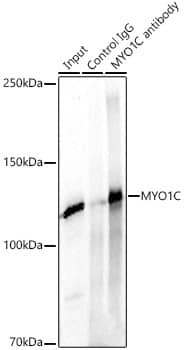 Immunoprecipitation: Myosin 1C Antibody - BSA Free [Myosin 1C] - Immunoprecipitation analysis of 300ug extracts of A549 cells using 3ug Myosin 1C Rabbit pAb . Western blot was performed from the immunoprecipitate using Myosin 1C Rabbit pAb  at a dilition of 1:1000.