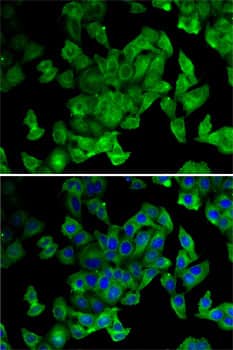 Immunocytochemistry/ Immunofluorescence: Periplakin Antibody - BSA Free [NBP2-95228] - Immunofluorescence analysis of MCF7 cells using Periplakin antibody (A6950). Blue: DAPI for nuclear staining.