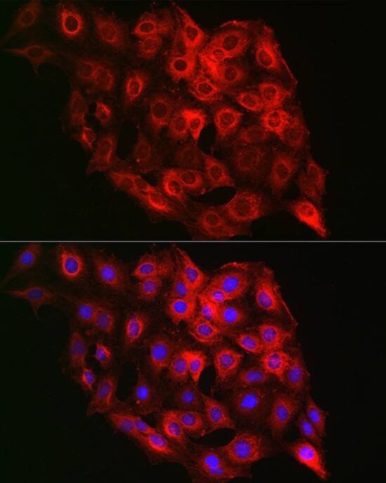 Immunocytochemistry/ Immunofluorescence: PSMD8 Antibody - BSA Free [NBP2-95230] - Immunofluorescence analysis of C6 cells using PSMD8 Rabbit pAb (A6955) at dilution of 1:100 (40x lens). Blue: DAPI for nuclear staining.