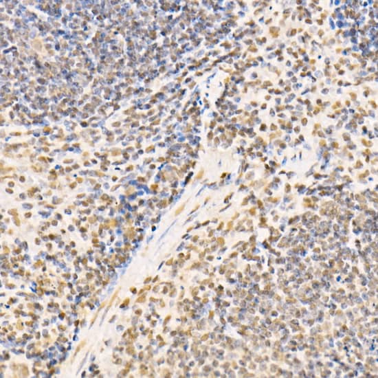 Immunohistochemistry SS18 Antibody - BSA Free