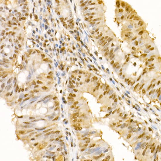 Immunohistochemistry SS18 Antibody - BSA Free