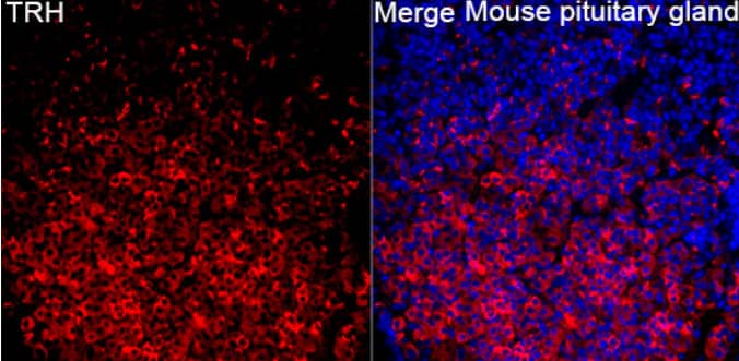 Immunohistochemistry:Thyrotropin Releasing Hormone Antibody [NBP2-95244] - Analysis of Mouse pituitary gland tissue using TRH Rabbit pAb at a dilution of 1:300 (40x lens). Secondary antibody: Cy3 Goat Anti-Rabbit IgG (H+L) at 1:500 dilution. Blue: DAPI for nuclear staining. High pressure antigen retrieval performed with 0.01M Citrate Buffer (pH 6.0) prior to IF staining.