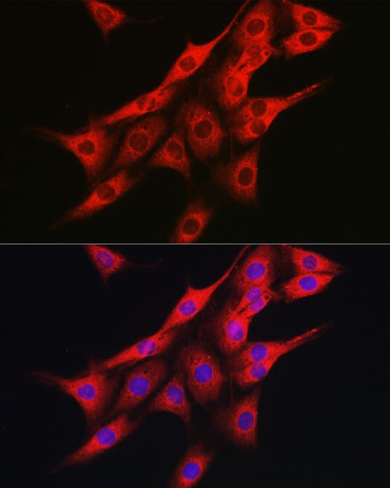 Immunocytochemistry/ Immunofluorescence: IRE1 alpha Antibody - Azide and BSA Free [IRE1 alpha] - Immunofluorescence analysis of PC-12 cells using IRE1 alpha Rabbit pAb  at dilution of 1:100 (40x lens). Secondary antibody: Cy3-conjugated Goat anti-Rabbit IgG (H+L)  at 1:500 dilution. Blue: DAPI for nuclear staining.