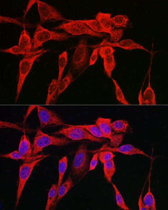 Immunocytochemistry/ Immunofluorescence: IRE1 alpha Antibody - Azide and BSA Free [IRE1 alpha] - Immunofluorescence analysis of U2OS cells using IRE1 alpha Rabbit pAb  at dilution of 1:100 (40x lens). Secondary antibody: Cy3-conjugated Goat anti-Rabbit IgG (H+L)  at 1:500 dilution. Blue: DAPI for nuclear staining.