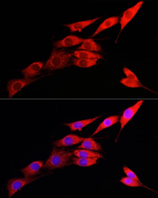 Immunocytochemistry/ Immunofluorescence: IRE1 alpha Antibody - Azide and BSA Free [IRE1 alpha] - Immunofluorescence analysis of NIH/3T3 cells using IRE1 alpha Rabbit pAb  at dilution of 1:100 (40x lens). Secondary antibody: Cy3-conjugated Goat anti-Rabbit IgG (H+L)  at 1:500 dilution. Blue: DAPI for nuclear staining.