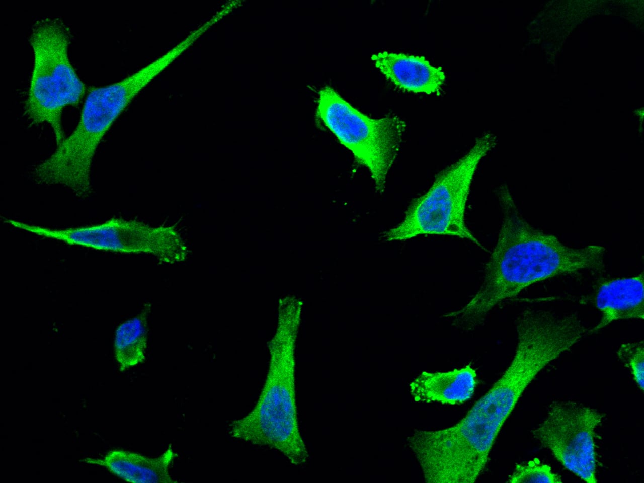 Immunocytochemistry/Immunofluorescence: NUDC Antibody [NBP2-96997] - Immunofluorescence staining of NUDC in HeLa cells. Cells were fixed with 4% PFA, permeabilzed with 0.3% Triton X-100 in PBS, blocked with 10% serum, and incubated with NBP2-96997 antibody (1:1000) at 4C overnight. Then cells were stained with the Alexa Fluor(R)488-conjugated Goat Anti-rabbit IgG secondary antibody (green) and counterstained with DAPI (blue). Positive staining was localized to cytoplasm.