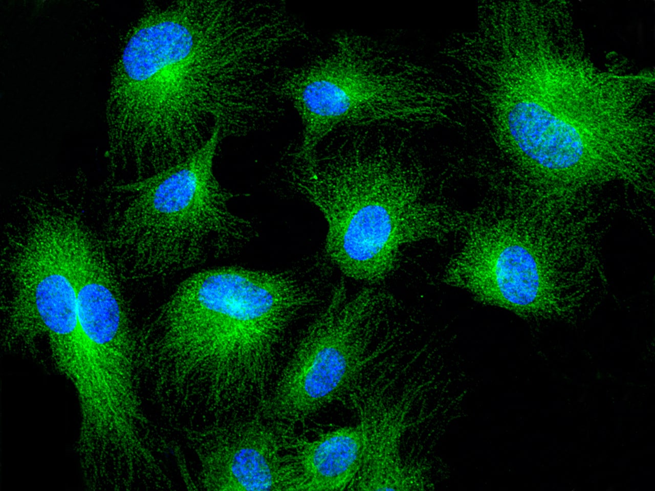 Immunocytochemistry/Immunofluorescence: MRPL44 Antibody [NBP2-96998] - Immunofluorescence staining of MRPL44 in HUVEC cells. Cells were fixed with 4% PFA, permeabilzed with 0.3% Triton X-100 in PBS, blocked with 10% serum, and incubated with NBP2-96998 antibody (dilution ratio 1:300) at 4C overnight. Then cells were stained with the Alexa Fluor$488-conjugated Goat Anti-rabbit IgG Secondary antibody (green) and counterstained with DAPI (blue).Positive staining was localized to cytoplasm.