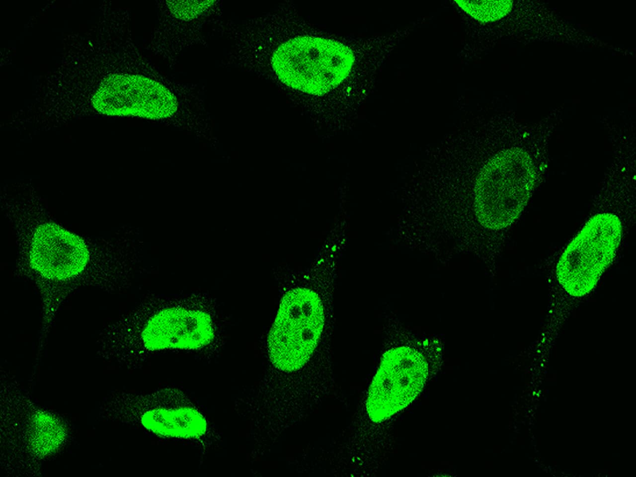 Immunocytochemistry/Immunofluorescence: Proteasome 20S alpha 3 Antibody [NBP2-97026] - Immunofluorescence staining of Proteasome 20S alpha 3 in HeLa cells. Cells were fixed with 4% PFA, permeabilzed with 0.3% Triton X-100 in PBS, blocked with 10% serum, and incubated with NBP2-97026 antibody (1:1000) at 4C overnight. Then cells were stained with the Alexa Fluor(R)488-conjugated Goat Anti-rabbit IgG Secondary antibody (green).Positive staining was localized to nucleus.