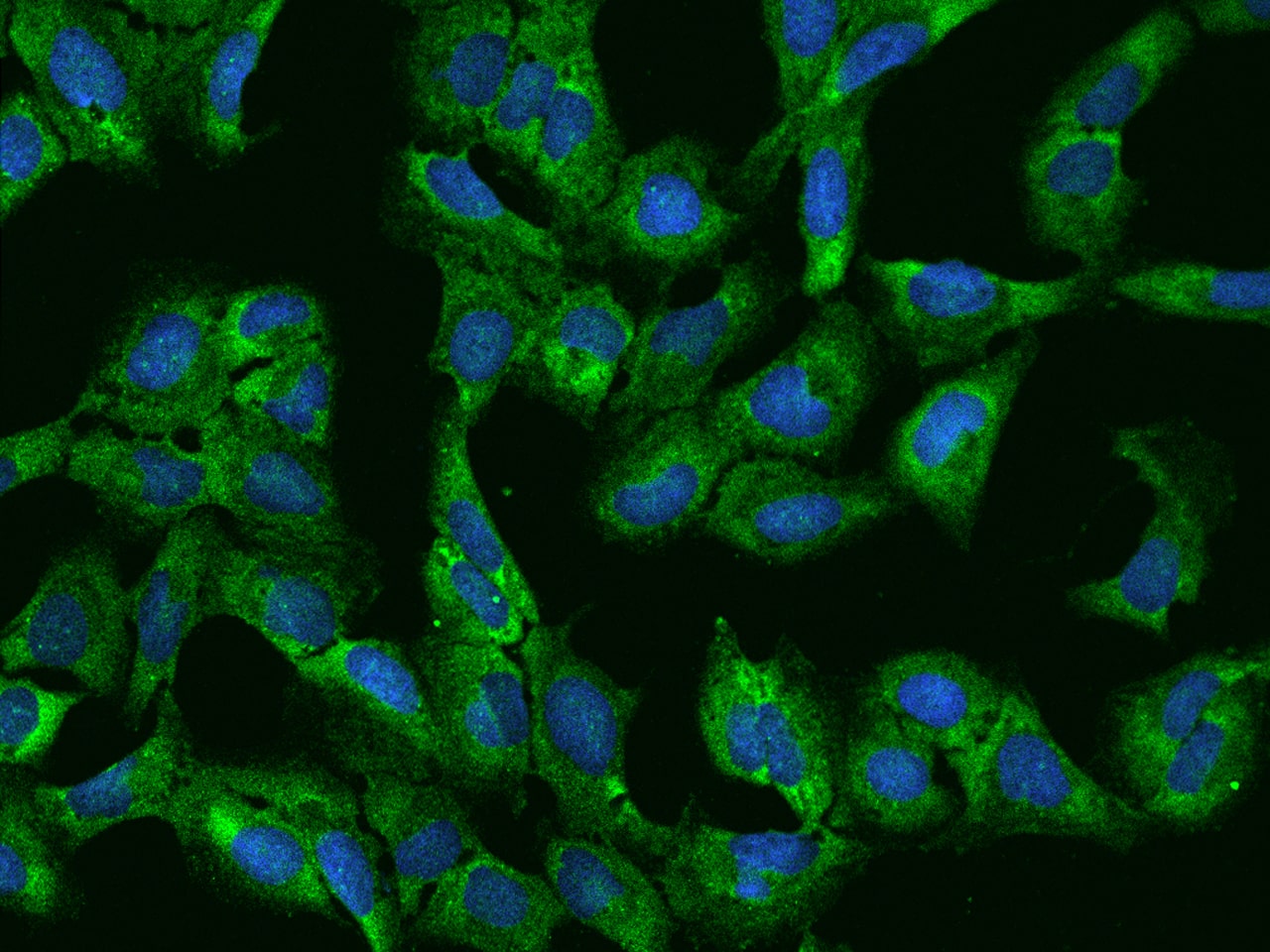 Immunocytochemistry/Immunofluorescence: PUM2 Antibody [NBP2-97161] - Immunofluorescence staining of PUM2 in U2OS cells. Cells were fixed with 4% PFA, permeabilzed with 0.1% Triton X-100 in PBS, blocked with 10% serum, and incubated with NBP2-97161 antibody (dilution ratio 1:200) at 4C overnight. Then cells were stained with the Alexa Fluor(R)488-conjugated Goat Anti-rabbit IgG Secondary antibody (green) and counterstained with DAPI (blue).Positive staining was localized to Cytoplasm.