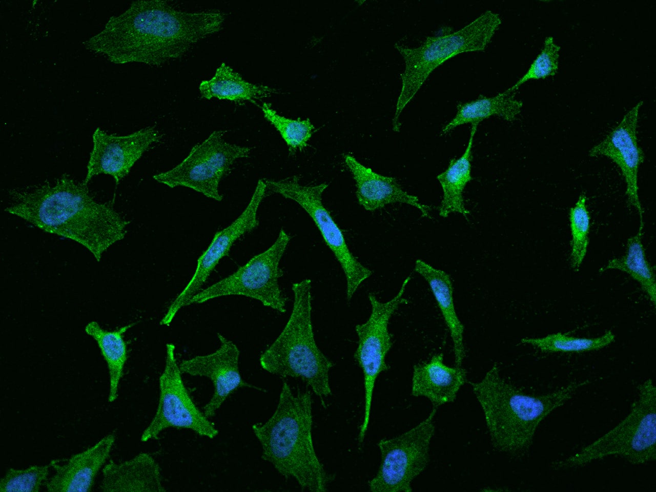Immunocytochemistry/Immunofluorescence: FLRT1 Antibody [NBP2-97173] - Immunofluorescence staining of FLRT1 in HeLa cells. Cells were fixed with 4% PFA, permeabilzed with 0.1% Triton X-100 in PBS, blocked with 10% serum, and incubated with NBP2-97173 antibody (dilution ratio 1:100) at 4C overnight. Then cells were stained with the Alexa Fluor(R)488-conjugated Goat Anti-rabbit IgG secondary antibody (green) and counterstained with DAPI (blue).Positive staining was localized to Cytoplasm and cell membrane.
