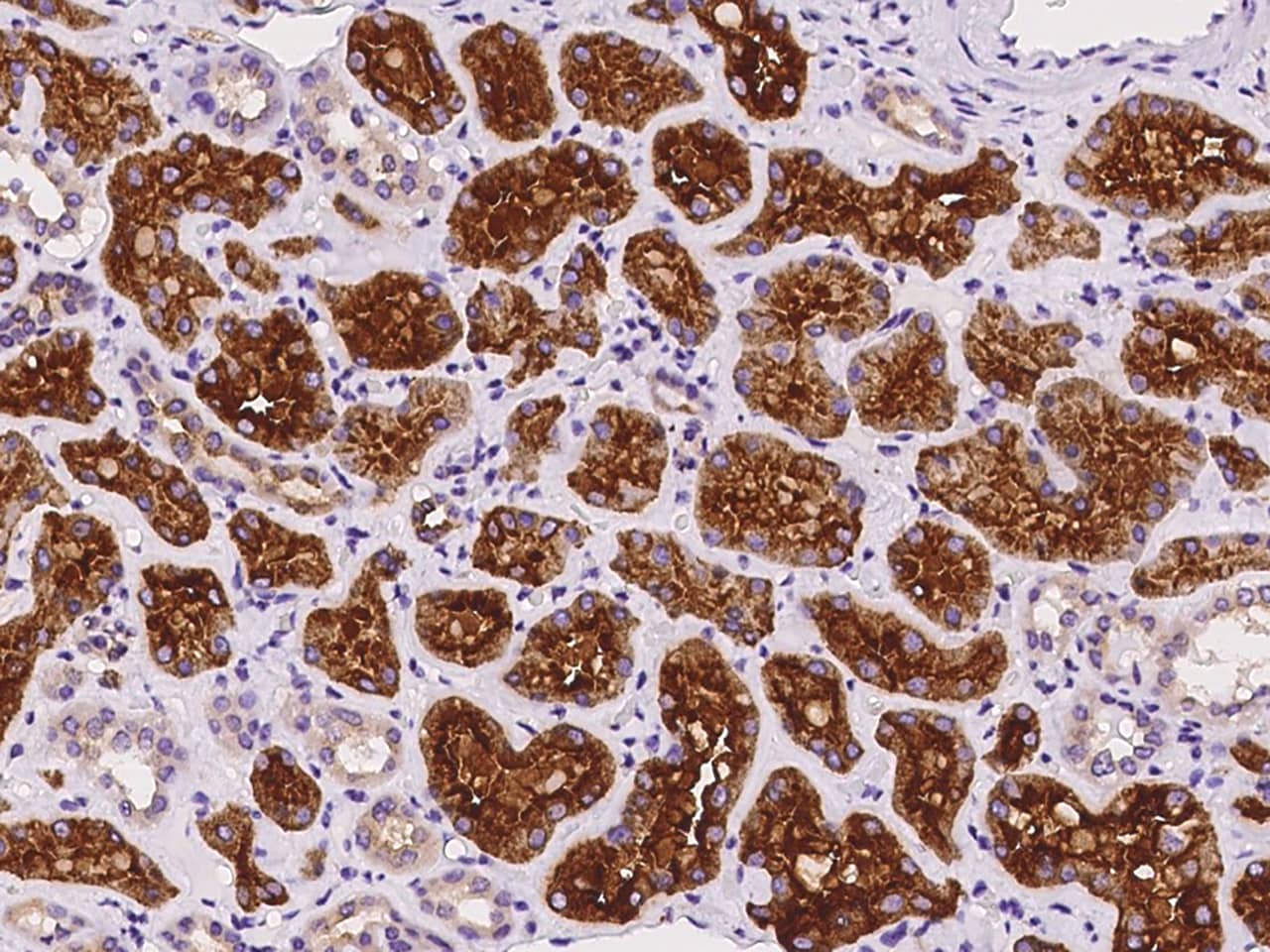 Immunohistochemistry-Paraffin: ATP6V1B2 Antibody - BSA Free [NBP2-97188] - Immunochemical staining of human ATP6V1B2 in human kidney with NBP2-97188 at 1:100 dilution, formalin-fixed paraffin embedded sections.