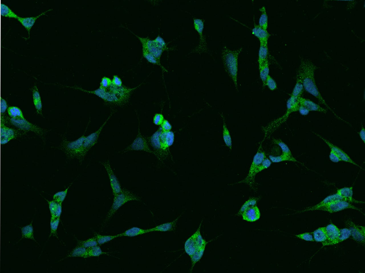 Immunocytochemistry/ Immunofluorescence RAB39B Antibody - BSA Free