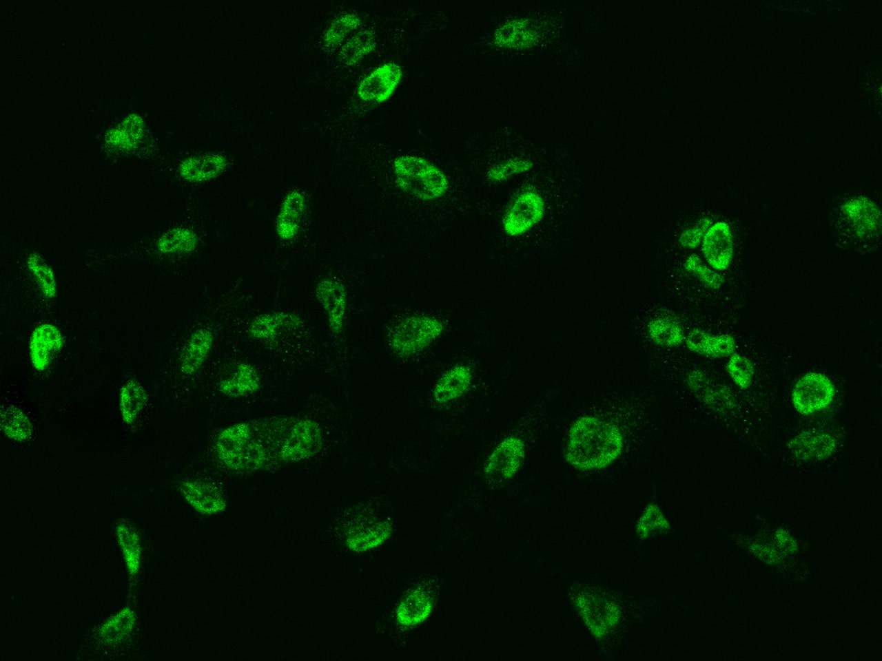 Immunocytochemistry/Immunofluorescence: GMEB1 Antibody [NBP2-97215] - Immunofluorescence staining of GMEB1 in U251MG cells. Cells were fixed with 4% PFA, permeabilzed with 0.3% Triton X-100 in PBS, blocked with 10% serum, and incubated with NBP2-97215 antibody (dilution ratio 1:200) at 4C overnight. Then cells were stained with the Alexa Fluor(R)488-conjugated Goat Anti-rabbit IgG secondary antibody (green). Positive staining was localized to .