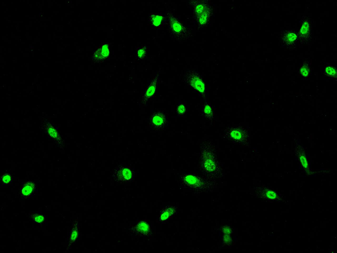 Immunocytochemistry/Immunofluorescence: Guanylate kinase Antibody [NBP2-97222] - Immunofluorescence staining of Guanylate kinase in PC3 cells. Cells were fixed with 4% PFA, permeabilzed with 0.1% Triton X-100 in PBS, blocked with 10% serum, and incubated with NBP2-97222 antibody (dilution ratio 1:200) at 4C overnight. Then cells were stained with the Alexa Fluor(R)488-conjugated Goat Anti-rabbit IgG secondary antibody (green). Positive staining was localized to Nucleus.