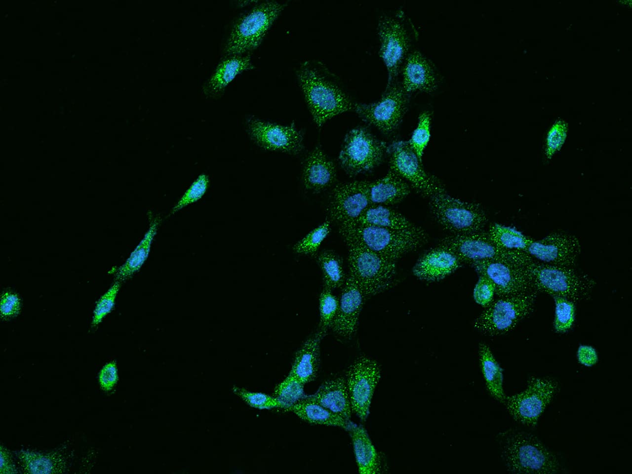 Immunocytochemistry/Immunofluorescence: Cyclin M3 Antibody [NBP2-97251] - Immunofluorescence staining of Cyclin M3 in A431 cells. Cells were fixed with 4% PFA, permeabilzed with 0.1% Triton X-100 in PBS, blocked with 10% serum, and incubated with NBP2-97251 antibody (dilution ratio 1:200) at 4C overnight. Then cells were stained with the Alexa Fluor(R)488-conjugated Goat Anti-rabbit IgG secondary antibody (green) and counterstained with DAPI (blue).Positive staining was localized to Cytoplasm.