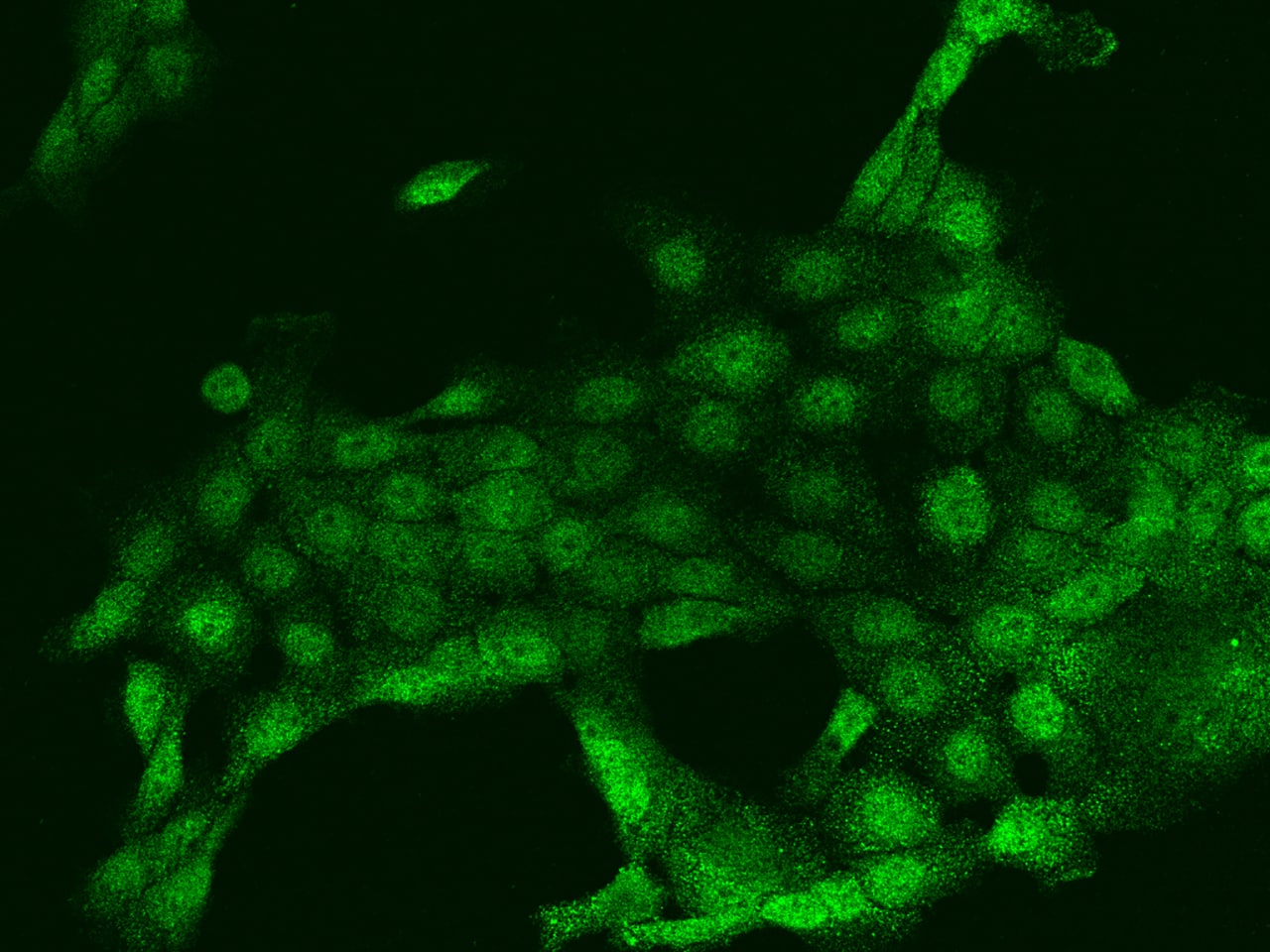 Immunocytochemistry/Immunofluorescence: PLA2G4F Antibody [NBP2-97276] - Immunofluorescence staining of PLA2G4F in A431 cells. Cells were fixed with 4% PFA, permeabilzed with 0.1% Triton X-100 in PBS, blocked with 10% serum, and incubated with NBP2-97276 antibody (dilution ratio 1:200) at 4C overnight. Then cells were stained with the Alexa Fluor(R)488-conjugated Goat Anti-rabbit IgG secondary antibody (green). Positive staining was localized to Nucleus and Cytoplasm.