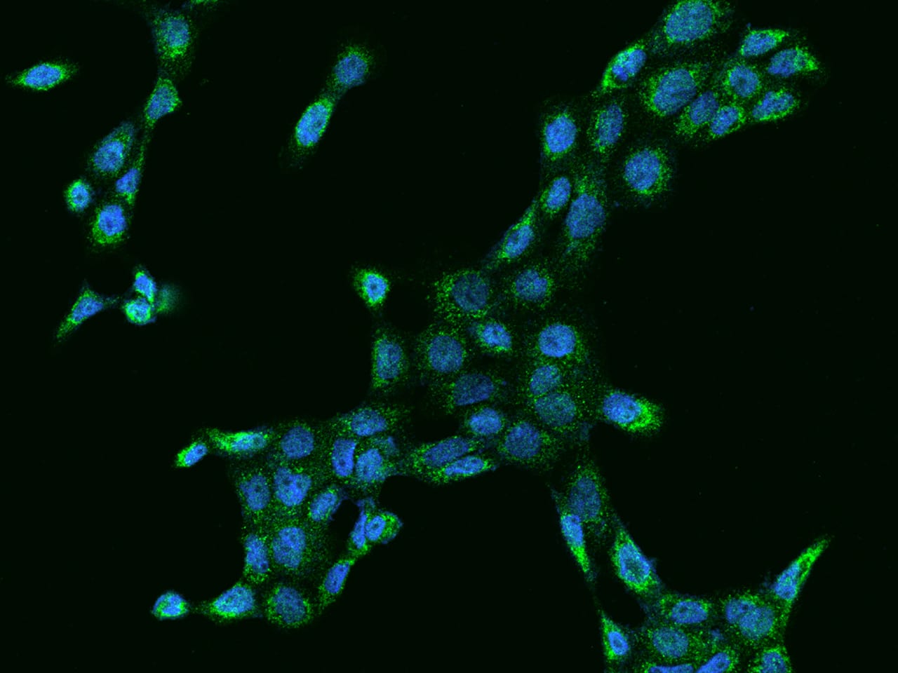 Immunocytochemistry/Immunofluorescence: MCCC2 Antibody [NBP2-97284] - Immunofluorescence staining of MCCC2 in A431 cells. Cells were fixed with 4% PFA, permeabilzed with 0.1% Triton X-100 in PBS, blocked with 10% serum, and incubated with NBP2-97284 antibody (dilution ratio 1:100) at 4C overnight. Then cells were stained with the Alexa Fluor(R)488-conjugated Goat Anti-rabbit IgG secondary antibody (green) and counterstained with DAPI (blue).Positive staining was localized to Cytoplasm.