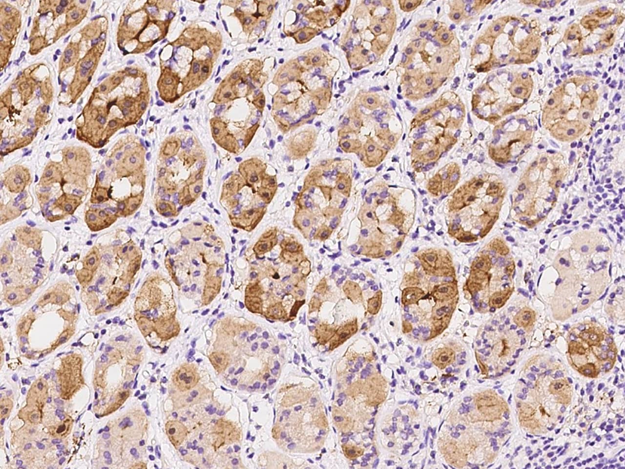 Immunohistochemistry-Paraffin: ST3GAL4 Antibody [NBP2-97314] - Immunochemical staining of human ST3GAL4 in human stomach with NBP2-97314 at 1:100 dilution, formalin-fixed paraffin embedded sections.