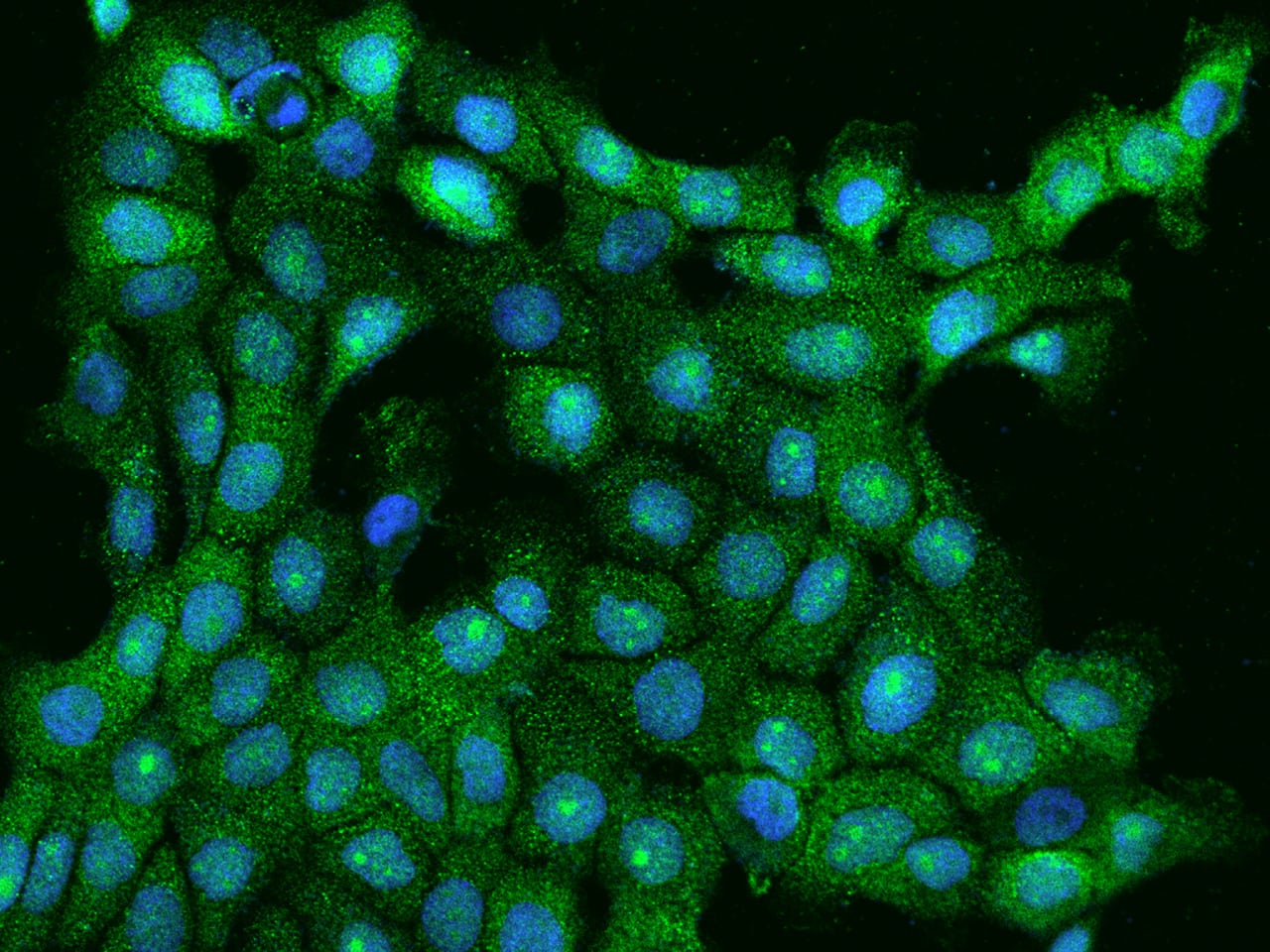 Immunocytochemistry/Immunofluorescence: ANKMY1 Antibody [NBP2-97343] - Immunofluorescence staining of ANKMY1 in A431 cells. Cells were fixed with 4% PFA, permeabilzed with 0.1% Triton X-100 in PBS, blocked with 10% serum, and incubated with NBP2-97343 antibody (dilution ratio 1:200) at 4C overnight. Then cells were stained with the Alexa Fluor(R)488-conjugated Goat Anti-rabbit IgG secondary antibody (green) and counterstained with DAPI (blue).Positive staining was localized to Nucleus and Cytoplasm.