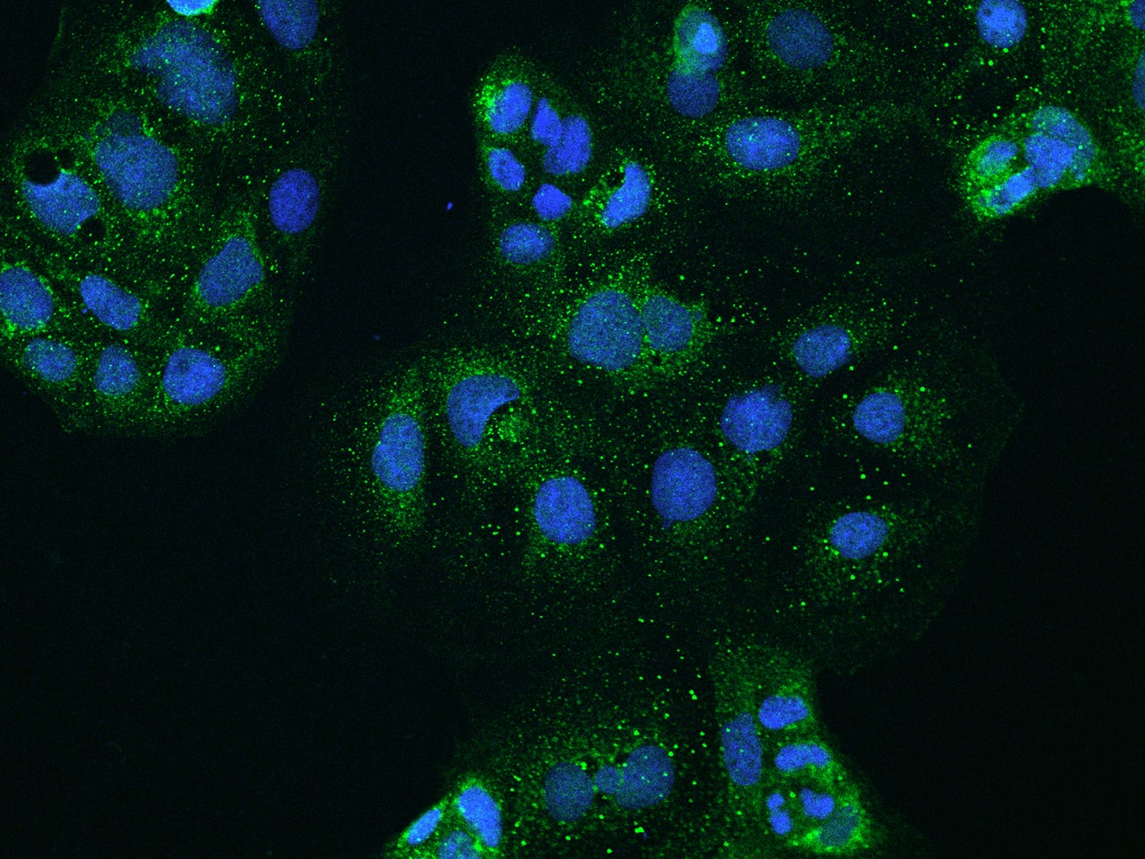 Immunocytochemistry/Immunofluorescence: CLCN2 Antibody [NBP2-97349] - Immunofluorescence staining of CLCN2 in CACO2 cells. Cells were fixed with 4% PFA, permeabilzed with 0.1% Triton X-100 in PBS, blocked with 10% serum, and incubated with NBP2-97349 antibody (dilution ratio 1:200) at 4C overnight. Then cells were stained with the Alexa Fluor(R)488-conjugated Goat Anti-rabbit IgG secondary antibody (green) and counterstained with DAPI (blue).Positive staining was localized to Cytoplasm.