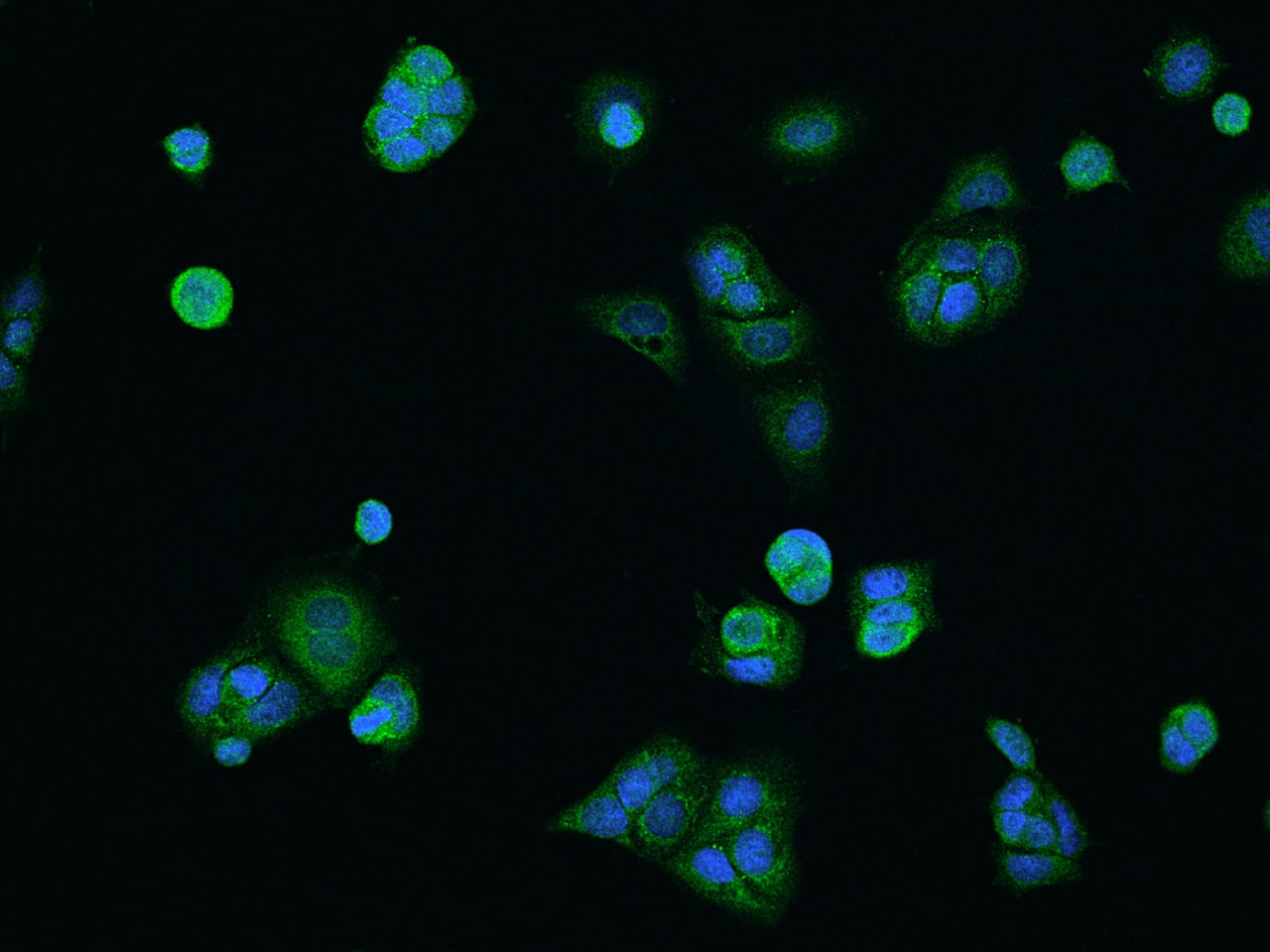 Immunocytochemistry/ Immunofluorescence COA5 Antibody - BSA Free