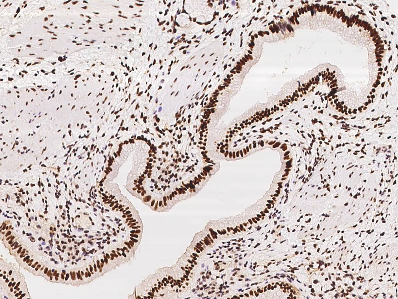 Immunohistochemistry-Paraffin: SP100 Antibody - BSA Free [NBP2-97408] - Immunochemical staining of human SP100 in human gallbladder with NBP2-97408 at 1:500 dilution, formalin-fixed paraffin embedded sections.
