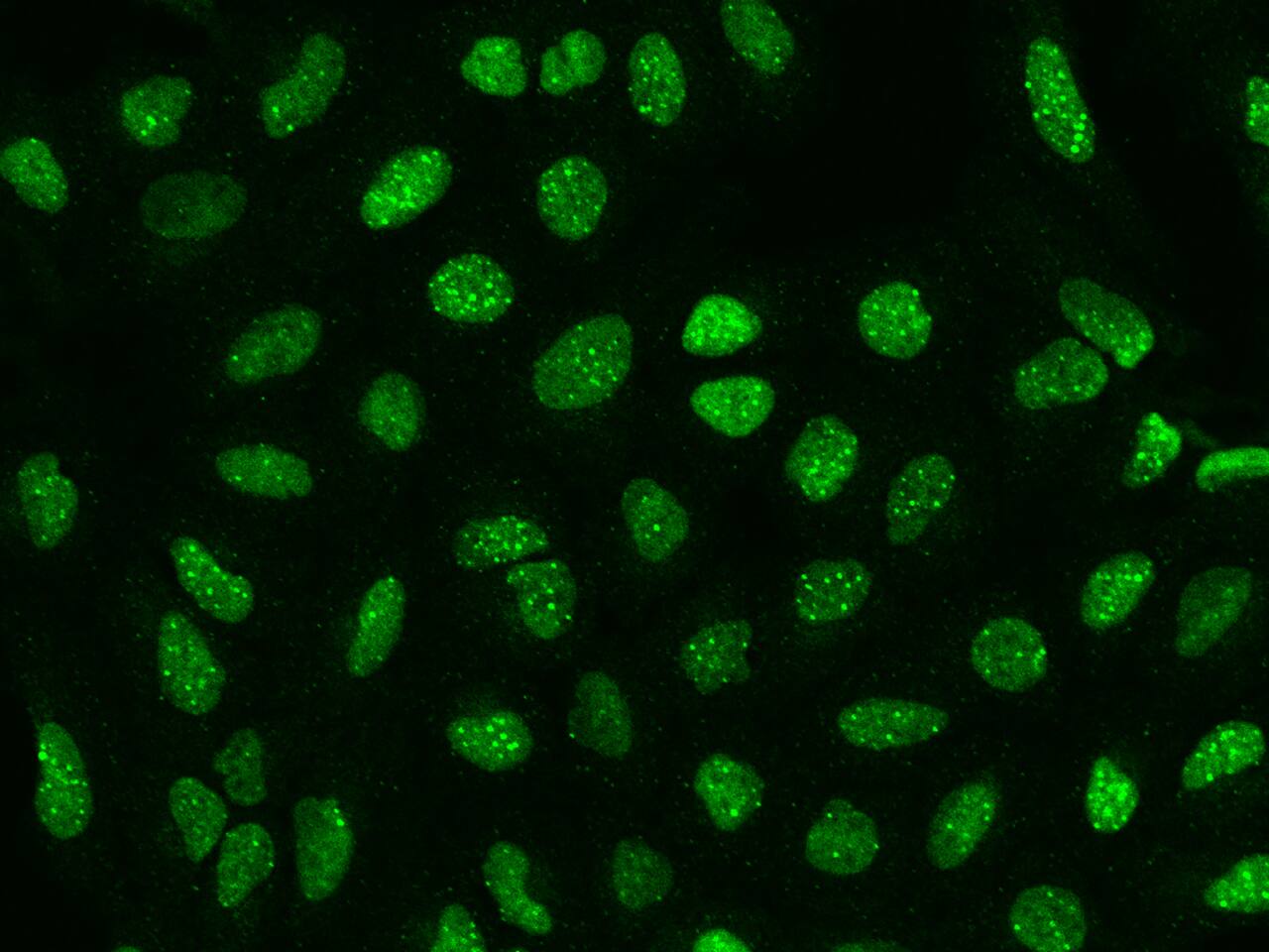 Immunocytochemistry/Immunofluorescence: SP100 Antibody [NBP2-97408] - Immunofluorescence staining of SP100 in U2OS cells. Cells were fixed with 4% PFA, permeabilzed with 0.1% Triton X-100 in PBS, blocked with 10% serum, and incubated with NBP2-97408 antibody (dilution ratio 1:200) at 4C overnight. Then cells were stained with the Alexa Fluor(R)488-conjugated Goat Anti-rabbit IgG secondary antibody (green). Positive staining was localized to Nucleus.