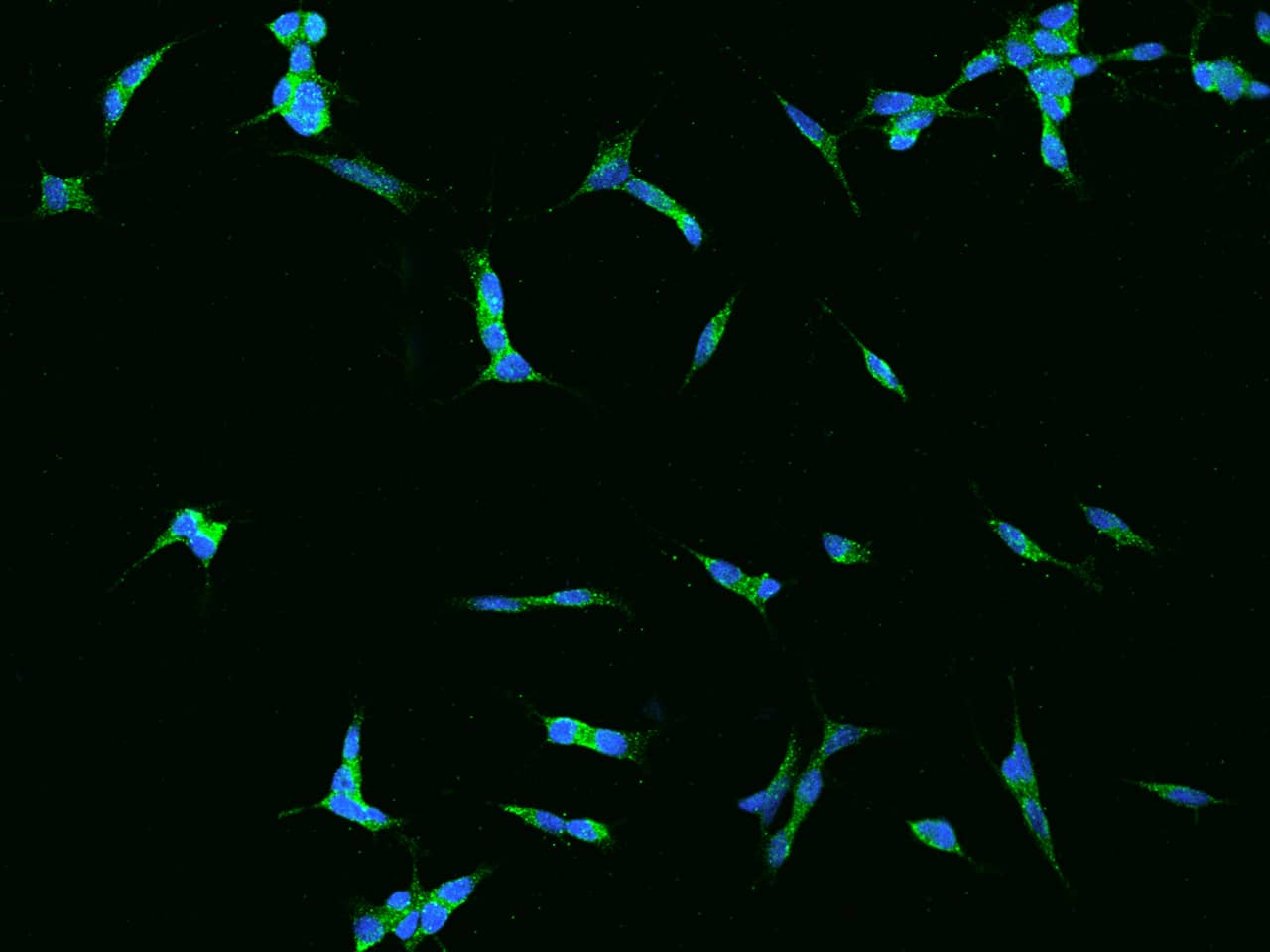 Immunocytochemistry/Immunofluorescence: PAC1R Antibody [NBP2-97421] - Immunofluorescence staining of PAC1R in SHSY5Y cells. Cells were fixed with 4% PFA, permeabilzed with 0.1% Triton X-100 in PBS, blocked with 10% serum, and incubated with NBP2-97421 antibody (dilution ratio 1:200) at 4C overnight. Then cells were stained with the Alexa Fluor(R)488-conjugated Goat Anti-rabbit IgG Secondary antibody (green) and counterstained with DAPI (blue).Positive staining was localized to Cytoplasm.
