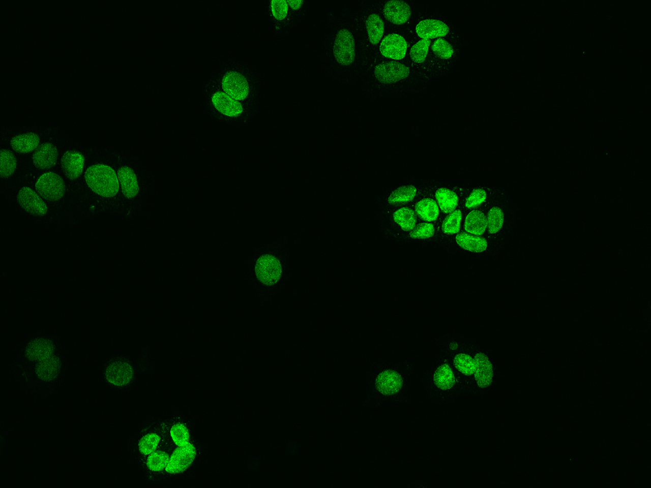 Immunocytochemistry/Immunofluorescence: NUP50 Antibody [NBP2-97442] - Immunofluorescence staining of NUP50 in MCF7 cells. Cells were fixed with 4% PFA, permeabilzed with 0.1% Triton X-100 in PBS, blocked with 10% serum, and incubated with NBP2-97442 antibody (dilution ratio 1:200) at 4C overnight. Then cells were stained with the Alexa Fluor(R)488-conjugated Goat Anti-rabbit IgG secondary antibody (green). Positive staining was localized to Nucleus.