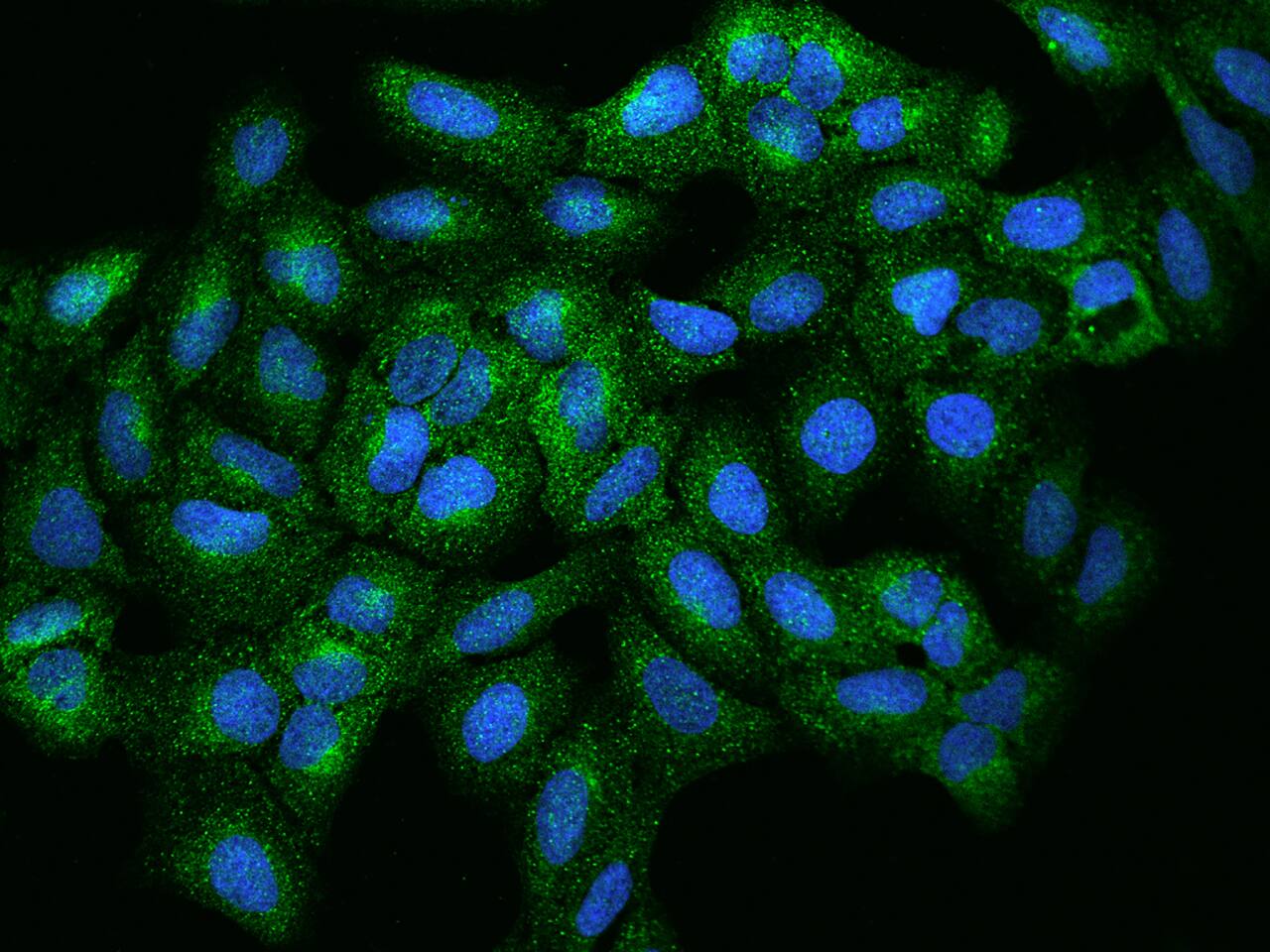 Immunocytochemistry/Immunofluorescence: RPIP8 Antibody [NBP2-97453] - Immunofluorescence staining of RPIP8 in U2OS cells. Cells were fixed with 4% PFA, permeabilzed with 0.1% Triton X-100 in PBS, blocked with 10% serum, and incubated with NBP2-97453 antibody (dilution ratio 1:200) at 4C overnight. Then cells were stained with the Alexa Fluor(R)488-conjugated Goat Anti-rabbit IgG secondary antibody (green) and counterstained with DAPI (blue).Positive staining was localized to Cytoplasm.