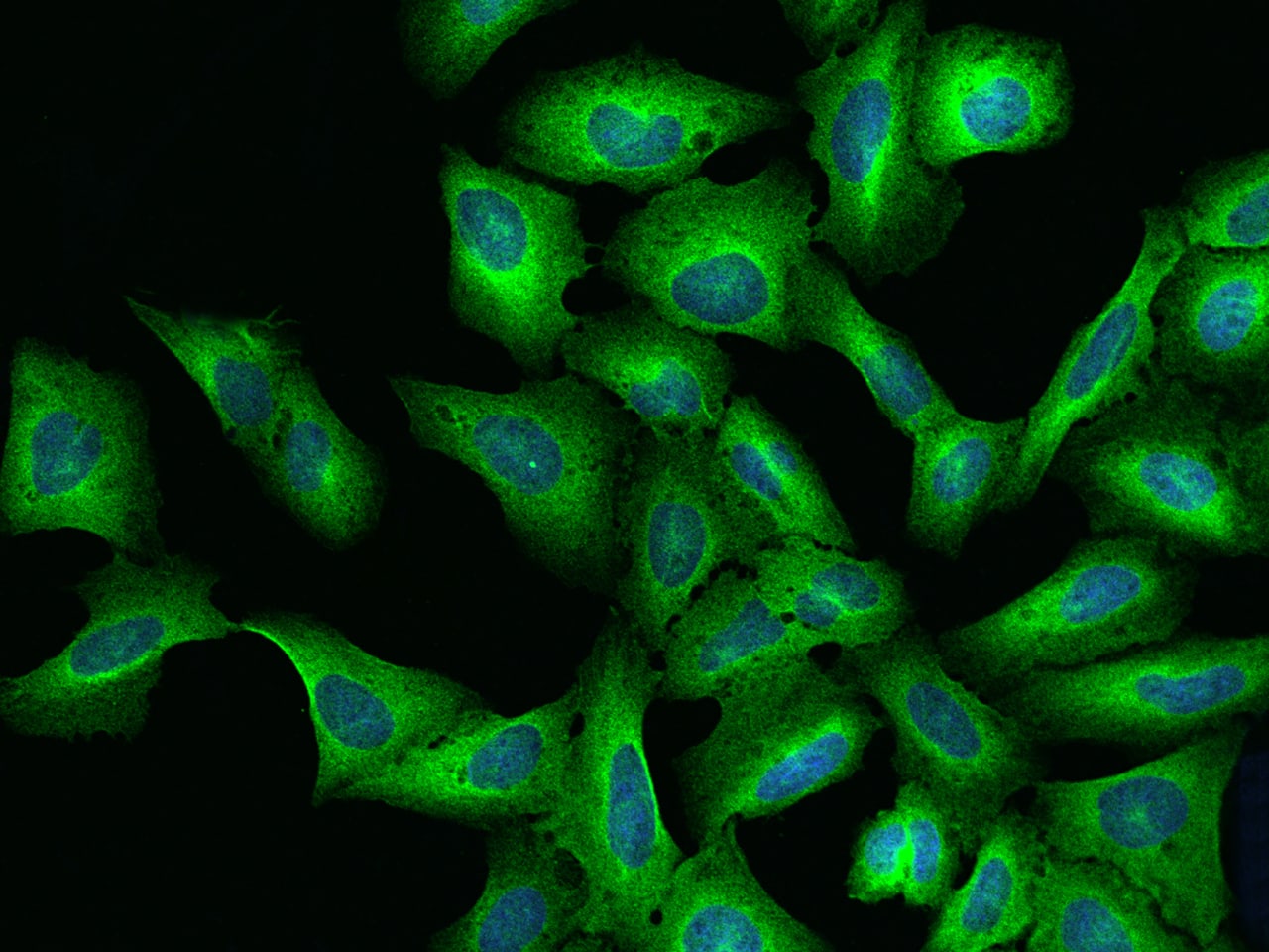 Immunocytochemistry/Immunofluorescence: LRRC8B Antibody [NBP2-97498] - Immunofluorescence staining of LRRC8B in U2OS cells. Cells were fixed with 4% PFA, permeabilzed with 0.1% Triton X-100 in PBS, blocked with 10% serum, and incubated with NBP2-97498 antibody (dilution ratio 1:200) at 4C overnight. Then cells were stained with the Alexa Fluor(R)488-conjugated Goat Anti-rabbit IgG secondary antibody (green) and counterstained with DAPI (blue).Positive staining was localized to Cytoplasm.
