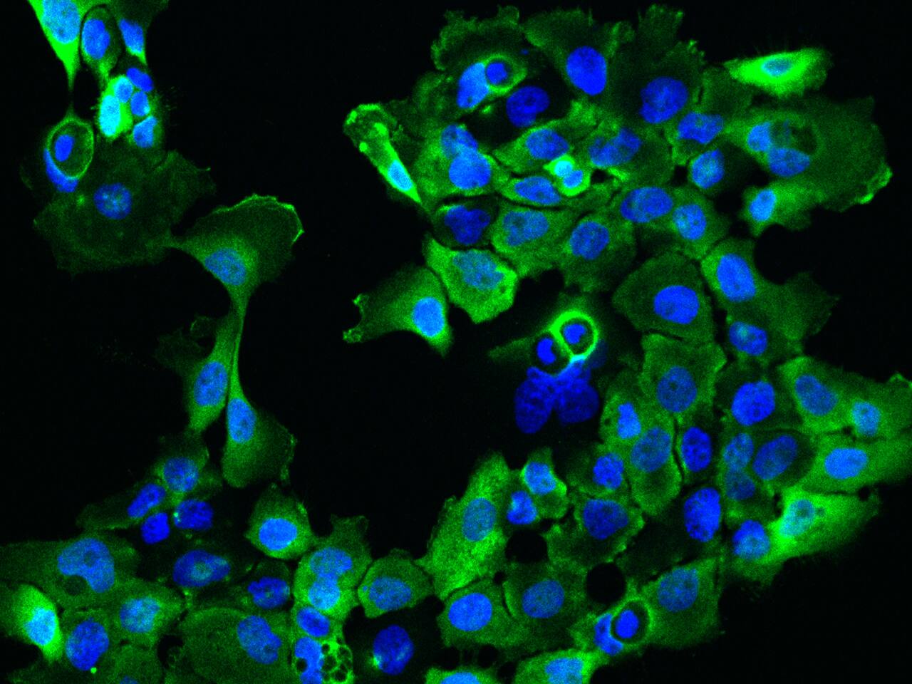 Immunocytochemistry/Immunofluorescence: SARG Antibody [NBP2-97505] - Immunofluorescence staining of SARG in A431 cells. Cells were fixed with 4% PFA, permeabilzed with 0.1% Triton X-100 in PBS, blocked with 10% serum, and incubated with NBP2-97505 antibody (dilution ratio 1:200) at 4C overnight. Then cells were stained with the Alexa Fluor(R)488-conjugated Goat Anti-rabbit IgG secondary antibody (green) and counterstained with DAPI (blue).Positive staining was localized to Cytoplasm and cell membrane.