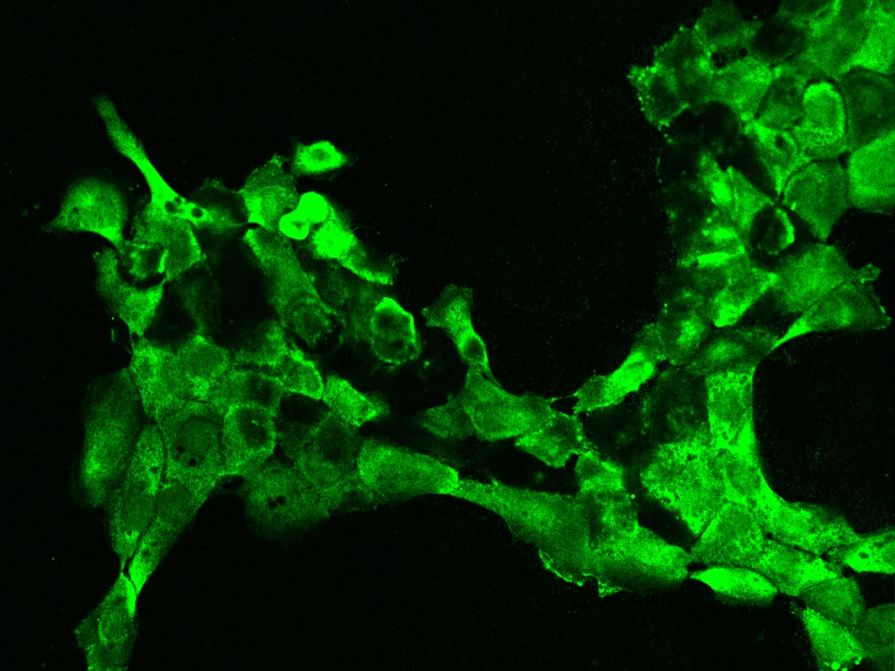 Immunocytochemistry/Immunofluorescence: EIF3J Antibody [NBP2-97521] - Immunofluorescence staining of EIF3J in A431 cells. Cells were fixed with 4% PFA, permeabilzed with 0.1% Triton X-100 in PBS, blocked with 10% serum, and incubated with NBP2-97521 antibody (dilution ratio 1:200) at 4C overnight. Then cells were stained with the Alexa Fluor(R)488-conjugated Goat Anti-rabbit IgG Secondary antibody (green). Positive staining was localized to Cytoplasm.