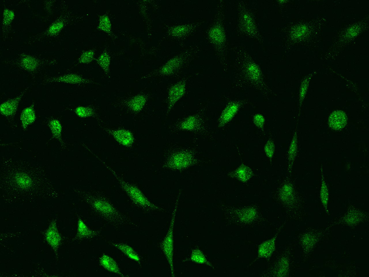 Immunocytochemistry/Immunofluorescence: DDX56 Antibody [NBP2-97523] - Immunofluorescence staining of DDX56 in Hela cells. Cells were fixed with 4% PFA, permeabilzed with 0.1% Triton X-100 in PBS, blocked with 10% serum, and incubated with NBP2-97523 antibody (dilution ratio 1:1000) at 4C overnight. Then cells were stained with the Alexa Fluor(R)488-conjugated Goat Anti-rabbit IgG secondary antibody (green). Positive staining was localized to Nucleus .