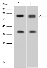 Western Blot: DDX56 Antibody - BSA Free [NBP2-97523] - NBP2-97523 at 1:500 dilution Lane A: HepG2 Whole Cell Lysate Lane B: U-251 MG Whole Cell Lysate Lysates/proteins at 30 ug per lane. Secondary Goat Anti-Rabbit IgG (H+L)/HRP at 1/10000 dilution. Developed using the ECL technique. Performed under reducing conditions. Predicted band size:61 kDa Observed band size:61 kDa 