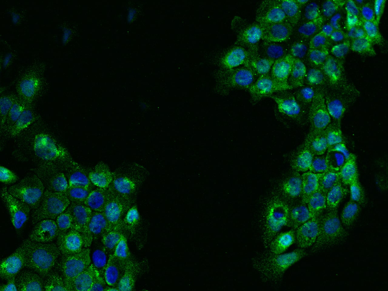 Immunocytochemistry/ Immunofluorescence FAR2 Antibody - BSA Free