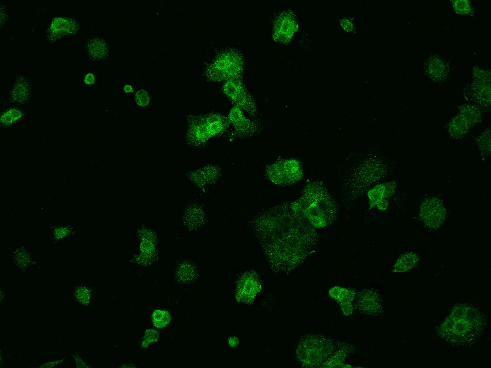 Immunocytochemistry/Immunofluorescence: VKORC1 Antibody [NBP2-97577] - Immunofluorescence staining of VKORC1 in MCF7 cells. Cells were fixed with 4% PFA, permeabilzed with 0.1% Triton X-100 in PBS, blocked with 10% serum, and incubated with NBP2-97577 antibody (dilution ratio 1:200) at 4C overnight. Then cells were stained with the Alexa Fluor(R)488-conjugated Goat Anti-rabbit IgG secondary antibody (green). Positive staining was localized to Cytoplasm.