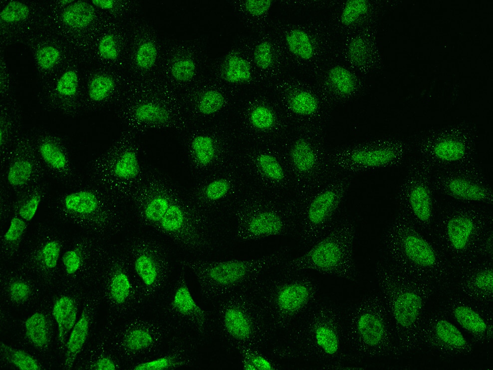 Immunocytochemistry/ Immunofluorescence TMEM38A Antibody - BSA Free