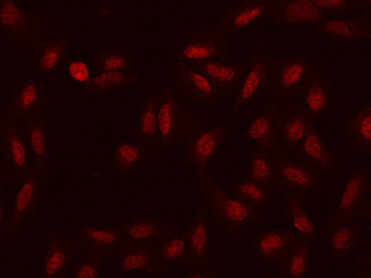 Immunocytochemistry/Immunofluorescence: HSD17B6 Antibody [NBP2-97586] - Immunofluorescence staining of HSD17B6 in U2OS cells. Cells were fixed with 4% PFA, permeabilzed with 0.1% Triton X-100 in PBS, blocked with 10% serum, and incubated with NBP2-97586 antibody (dilution ratio 1:100) at 4C overnight. Then cells were stained with the Alexa Fluor(R)594-conjugated Goat Anti-rabbit IgG secondary antibody (red). Positive staining was localized to Nucleus.
