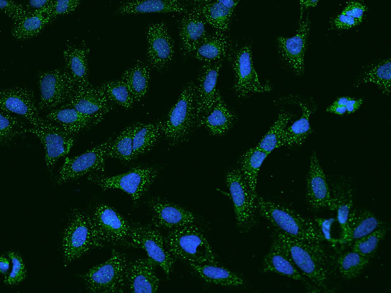 Immunocytochemistry/Immunofluorescence: SCCPDH Antibody [NBP2-97630] - Immunofluorescence staining of SCCPDH in U2OS cells. Cells were fixed with 4% PFA, permeabilzed with 0.1% Triton X-100 in PBS, blocked with 10% serum, and incubated with NBP2-97630 antibody (dilution ratio 1:200) at 4C overnight. Then cells were stained with the Alexa Fluor(R)488-conjugated Goat Anti-rabbit IgG secondary antibody (green) and counterstained with DAPI (blue).Positive staining was localized to Cytoplasm.