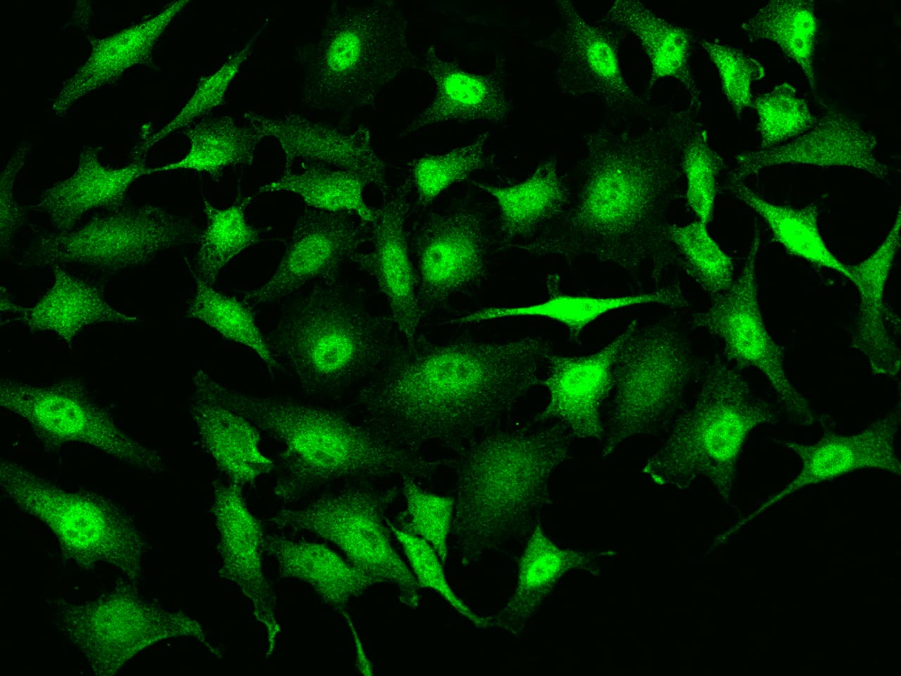 Immunocytochemistry/Immunofluorescence: RMND5B Antibody [NBP2-97633] - Immunofluorescence staining of RMND5B in HeLa cells. Cells were fixed with 4% PFA, permeabilzed with 0.1% Triton X-100 in PBS, blocked with 10% serum, and incubated with NBP2-97633 antibody (dilution ratio 1:200) at 4C overnight. Then cells were stained with the Alexa Fluor(R)488-conjugated Goat Anti-rabbit IgG secondary antibody (green). Positive staining was localized to Nucleus and cytoplasm.