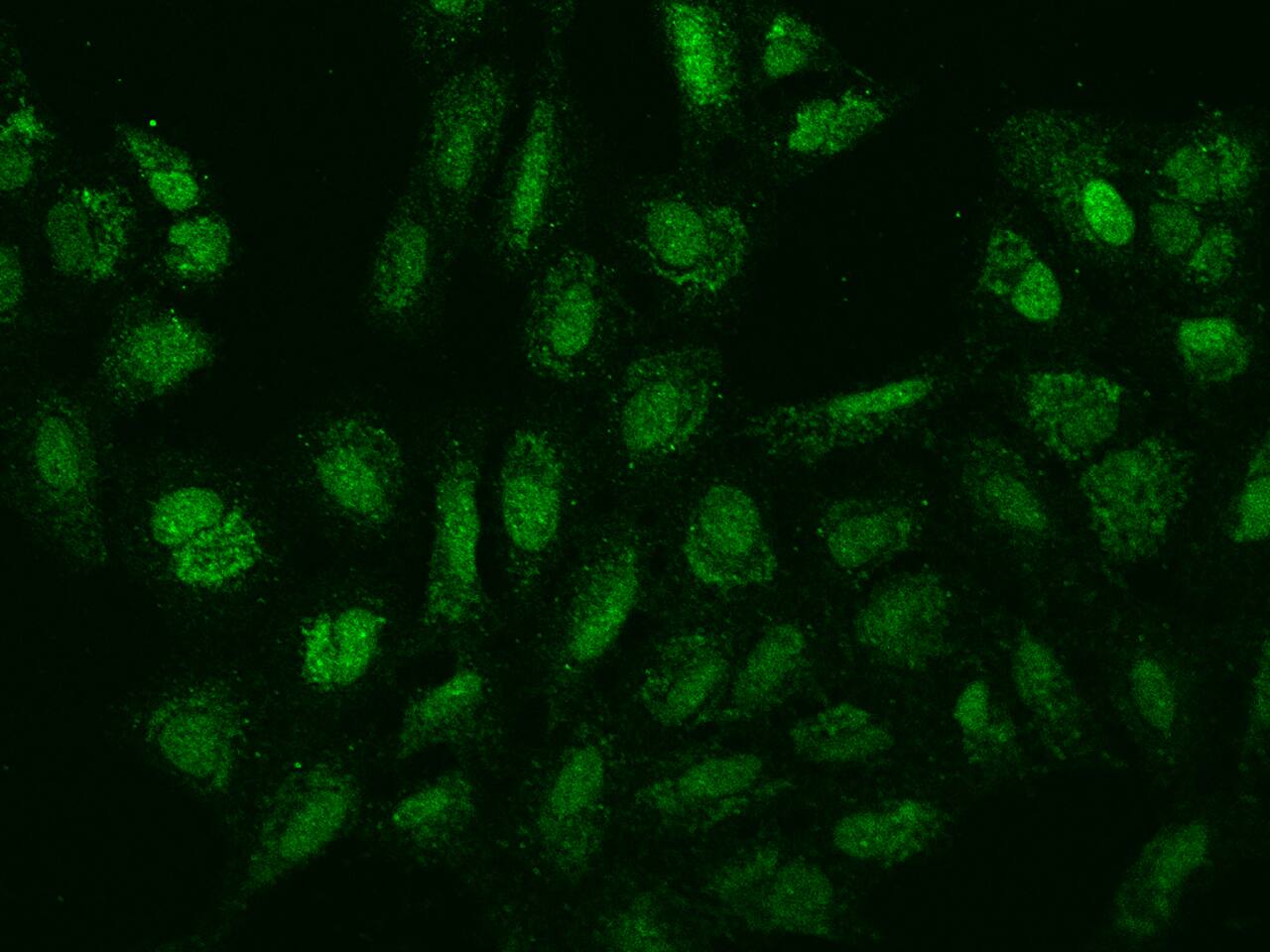 Immunocytochemistry/Immunofluorescence: SPIN4 Antibody [NBP2-97667] - Immunofluorescence staining of SPIN4 in U2OS cells. Cells were fixed with 4% PFA, permeabilzed with 0.1% Triton X-100 in PBS, blocked with 10% serum, and incubated with NBP2-97667 antibody (dilution ratio 1:100) at 4C overnight. Then cells were stained with the Alexa Fluor(R)488-conjugated Goat Anti-rabbit IgG secondary antibody (green). Positive staining was localized to Nucleus and cytoplasm.