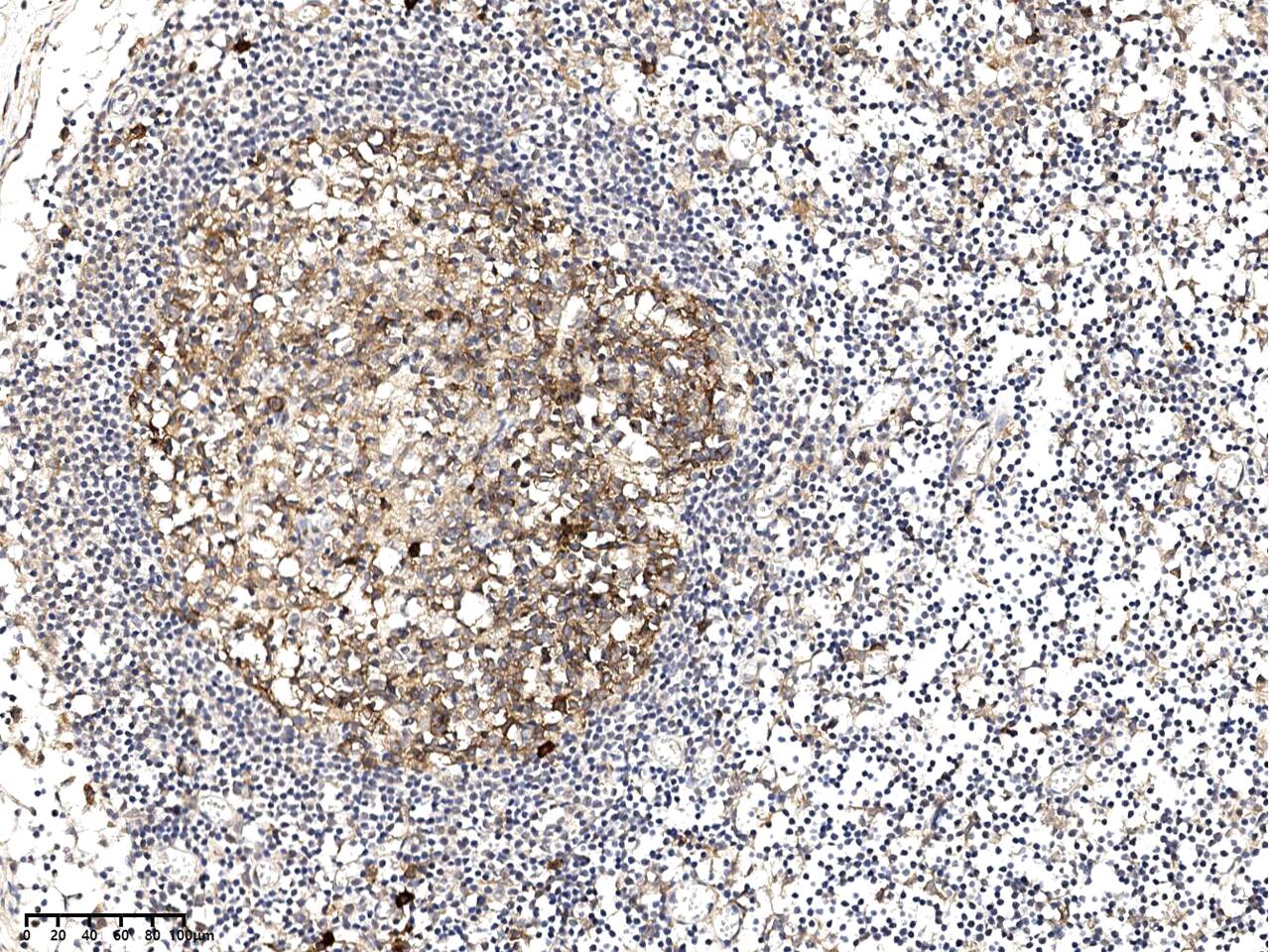 Immunohistochemistry-Paraffin: SLC1A4 Antibody [NBP2-97677] - Immunochemical staining of human SLC1A4 in human lymph node with NBP2-97677 at 1:1000 dilution, formalin-fixed paraffin embedded sections.