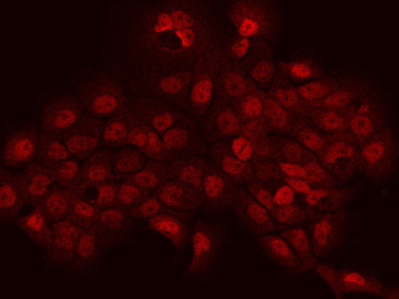 Immunocytochemistry/ Immunofluorescence PHTF2 Antibody - BSA Free