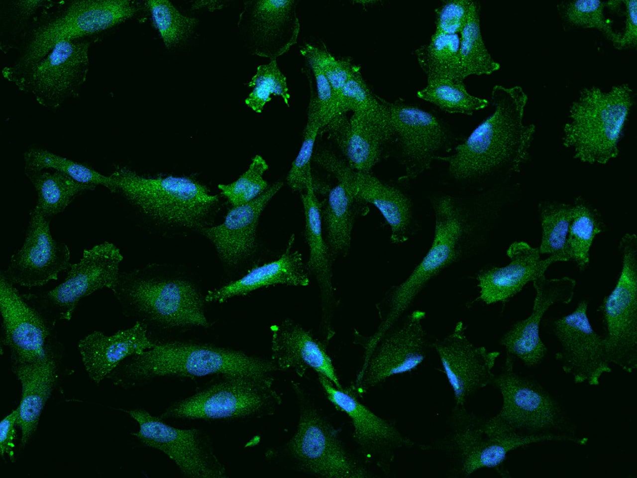 Immunocytochemistry/Immunofluorescence: PYGL Antibody [NBP2-97708] - Immunofluorescence staining of PYGL in U251MG cells. Cells were fixed with 4% PFA, permeabilzed with 0.1% Triton X-100 in PBS, blocked with 10% serum, and incubated with NBP2-97708 antibody (dilution ratio 1:200) at 4C overnight. Then cells were stained with the Alexa Fluor(R)488-conjugated Goat Anti-rabbit IgG secondary antibody (green) and counterstained with DAPI (blue).Positive staining was localized to Cytoplasm and cell membrane.